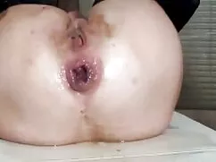 私は最終的に私の背中にボトルを持っていま ...